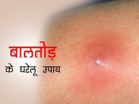 बालतोड़ क्यों होता है? जाने इसके 5 बेहतरीन घरेलू उपचार