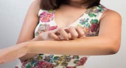 Stung by a bee? Try these fool-proof natural solutions