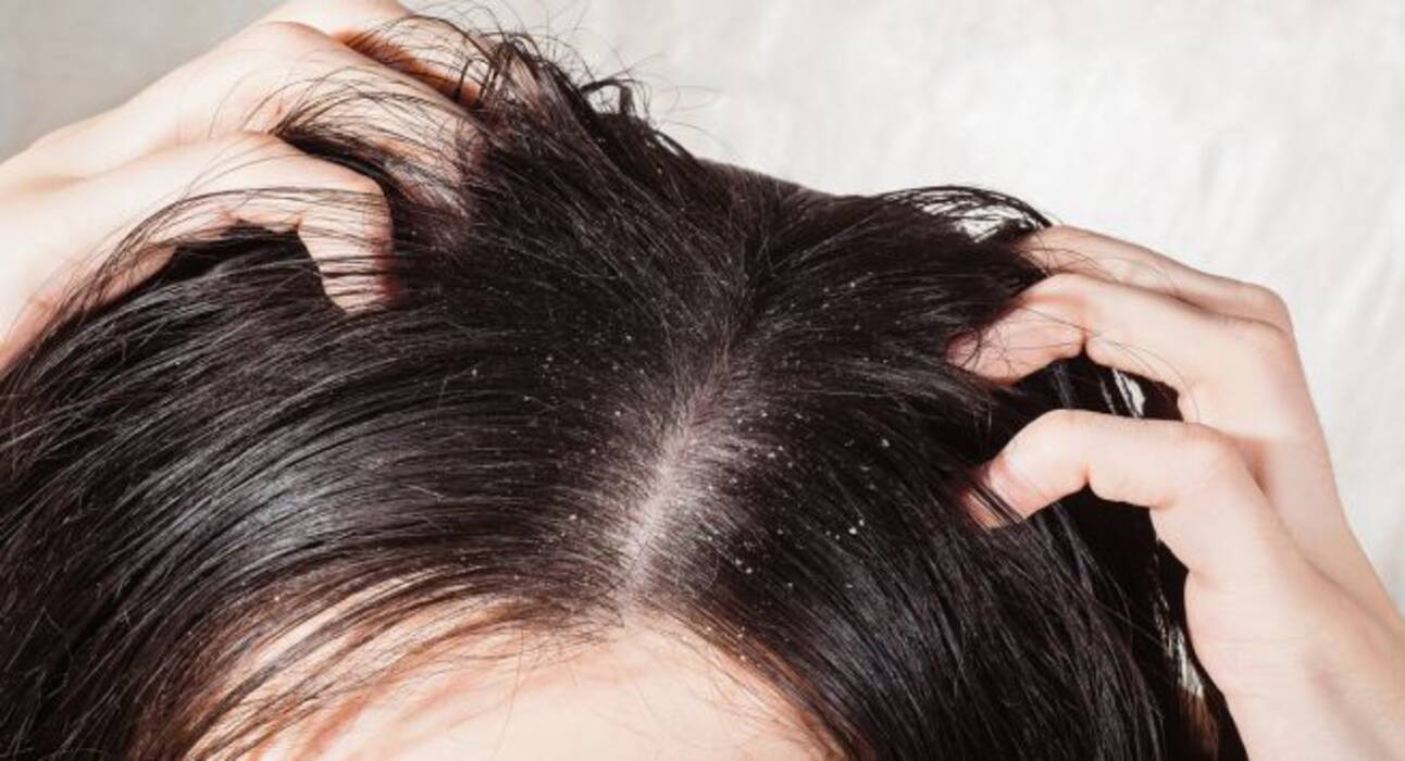 7 Ayurvedic hair care tips you need to follow