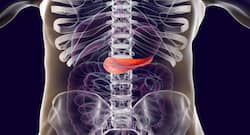 Chronic Pancreatitis: Treatment Options And Post-Recovery Care