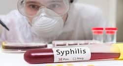 Want to tackle Syphilis? Go au naturel