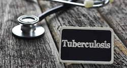 First non-antibiotic drug for TB to be trialled on humans in 3 years