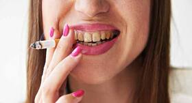  Stain on your teeth? Here are your culprits