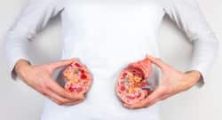 किडनी में पथरी होने पर इन 4 चीजों कम कर दे सेवन