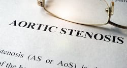 All you need to know about Aortic Valve Stenosis