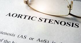 All you need to know about Aortic Valve Stenosis