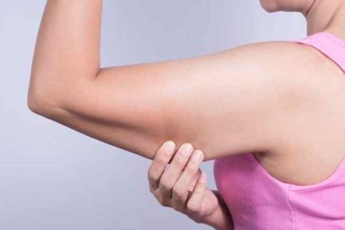 How To Deal With Flabby Arms Thehealthsite Com