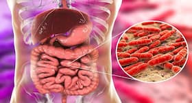 The bacteria in your gut can give you type 2 diabetes, finds study