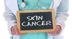 Woman’s chickenpox scar turns into deadly skin cancer: What might have caused it?