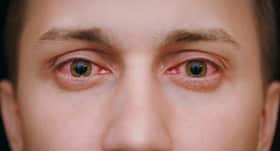 Man overdoses on erectile dysfunction medication land up with permanent eye damage