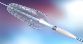 This government based hospital did angioplasty and stent procedure for free on 200 patients