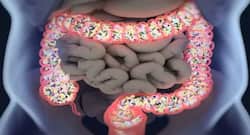 gas and acidity treatment colon health