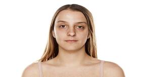Home remedies that help you get rid of dark circles