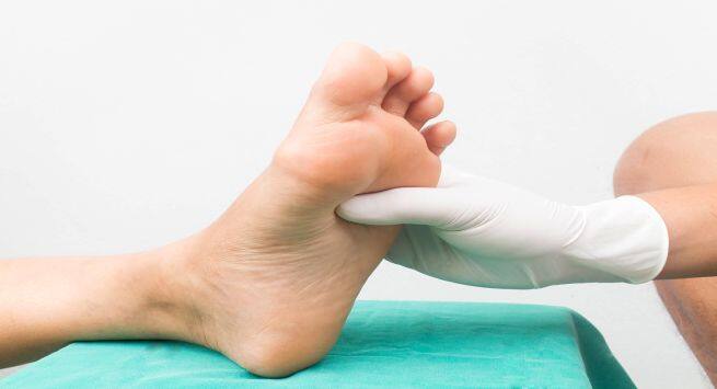 Diabetic feet: Tips for diabetic neuropathy | TheHealthSite.com