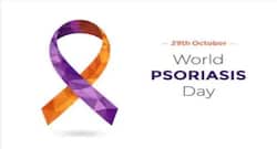 चाहते हैं न हो सोरायसिस, तो दूर रहें इन 4 चीजों से