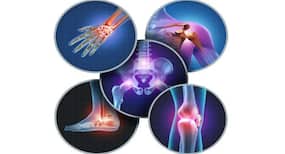 3D-printing process for implantable human ligaments, tendons developed by scientists
