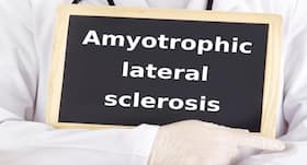 Facts about amyotrophic lateral sclerosis
