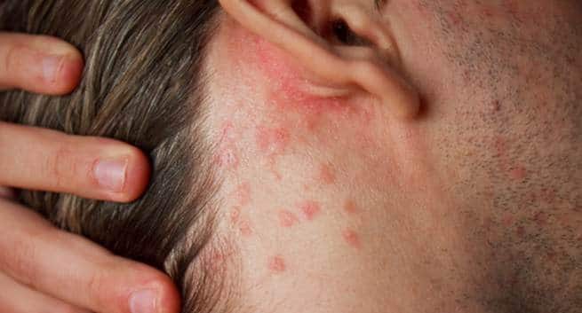 वर ल ड स र यस स ड 2018 स र यस स ह न पर ऐस रख स क न क ख य ल Thehealthsite Com ह द