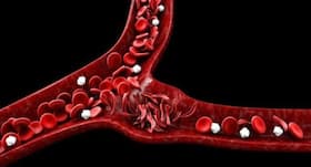 World Sickle Cell Day: Symptoms of Sickle Cell Disease in Teenagers, Consequences Of Delayed Treatment World Sickle Cell Day: Symptoms of Sickle Cell Disease in Teenagers, Consequences Of Delayed Treatment