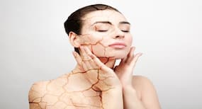 5 simple beauty hacks to keep your skin healthy during winter