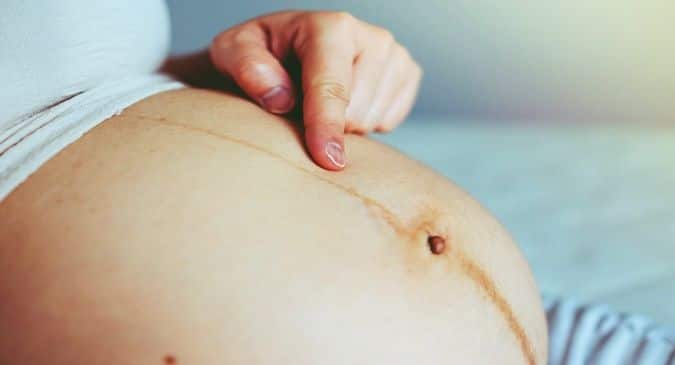 Linea nigra: Everything you need to know about pregnancy belly line