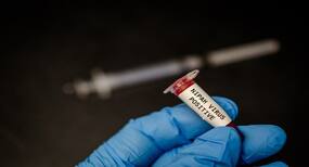 Nipah virus: Simple hacks of checking the spread of this deadly infection