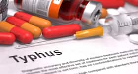 Everything you need to know about typhus Everything you need to know about typhus