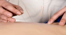 Acupuncture can help ease indigestion symptoms: Know more about this ancient Chinese healing practice