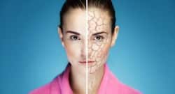 Winter-proof your skin with these amazing tips