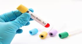 First lead-poisoning detection and treatment centre opens in Kerala