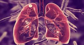 Lung disease linked to dementia in later life: Study Lung disease linked to dementia in later life: Study