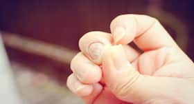 Want to treat nail fungus? Try these natural solutions