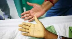 Detect anemia without blood test with this novel smartphone app