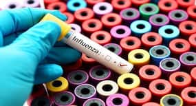 Anti-viral composition to fight influenza A viruses
