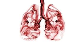IIT Kharagpur researchers develop tools to detect interstitial lung diseases and lung cancer, says report