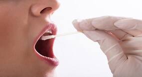 Saliva test can help in diagnosis of Alzheimer's disease, say scientists Saliva test can help in diagnosis of Alzheimer's disease, say scientists