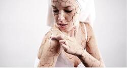 सर्दी में त्वचा में होती है खुजली तो इन 4 में से कोई एक उपाय को अपनाकर देखें