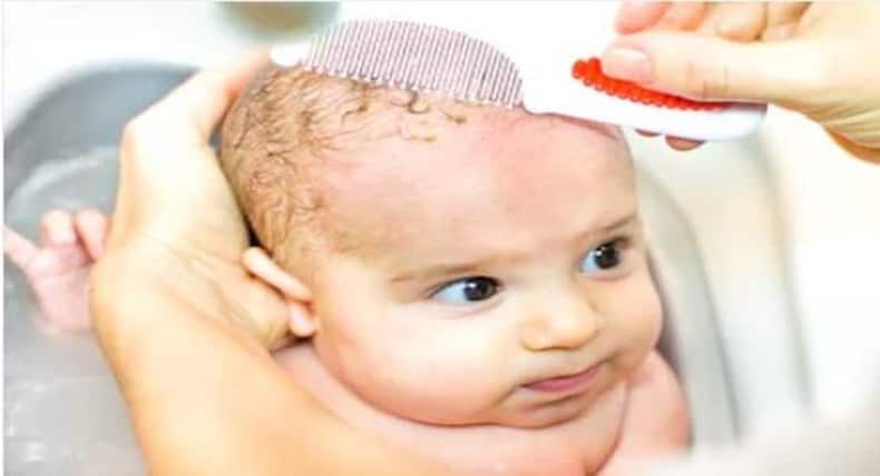 इस तरह हटाएं शिशु के सिर पर जमने वाली पीली पपड़ी
