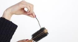 5 reasons why you are losing your hair