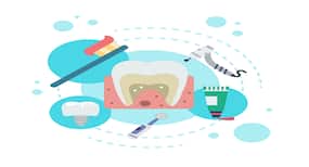 Use these oils for strong teeth
