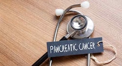 Tongue bacteria can detect early stage of pancreatic cancer: Study