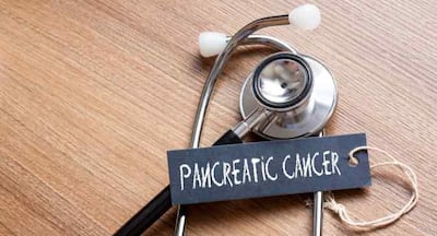 Tongue bacteria can detect early stage of pancreatic cancer: Study ...