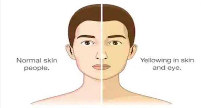 Skin-problem-and-liver-toxin-in-hindi