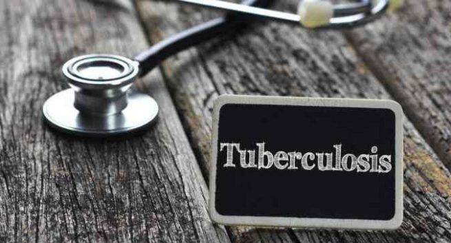Tuberculose "title =" Plus de 8 patients atteints de la tuberculose-tuberculose ont bénéficié du régime de la DBT "/><p> Le 1 er janvier 2019, sur 20,94 lahls bénéficiaires éligibles, 8,78 lakh (42%) ont bénéficié des avantages du régime. © Shutterstock</p></div><div id=