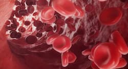 ज्‍यादातर महिलाएं हैं एनीमिया की शिकार, जानिए शरीर में कितना हीमोग्‍लोबिन होना है जरूरी