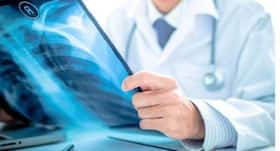New AI-powered system can speed-up the process time for abnormal chest X-rays