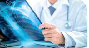 New AI-powered system can speed-up the process time for abnormal chest X-rays