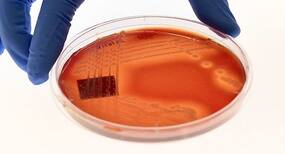 Genes associated with antibiotic-resistant superbug found in Arctic Genes associated with antibiotic-resistant superbug found in Arctic