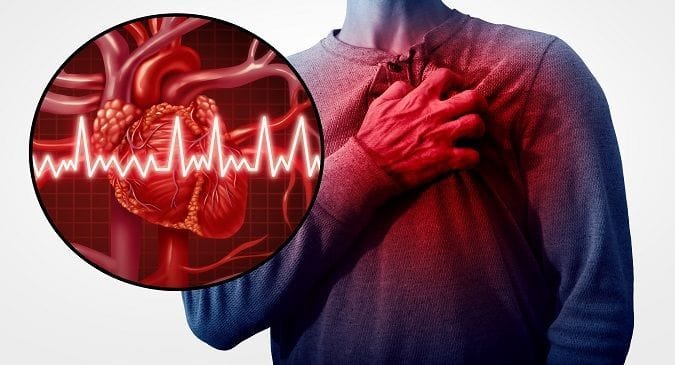 Anti-inflammatory drugs linked to increased heart attack risk: Study ...