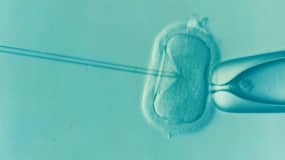 आईवीएफ (IVF) कई बार हो जाता फेल, जानें कारण और सतर्कता